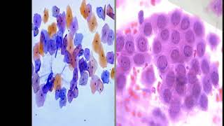 Histological staining procedure [upl. by Mauretta]