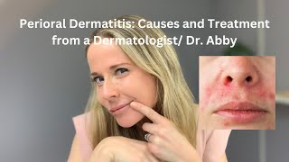 Perioral dermatitis causes and treatment from a Dermatologist [upl. by Annoyt]