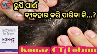 ରୁପି ପାଈଁ ବ୍ଯବହାର କରିବା Konaz CT Lotion Uses for Dandruff Psoriasis Skin infection Allergies Re [upl. by Raviv568]