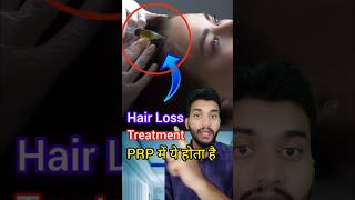 PRP treatment Hair Loss Treatment shorts [upl. by Rezeile]