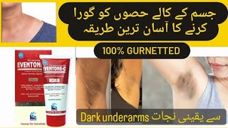 Whitening of Dark underarms  Eventone C cream uses [upl. by Rolanda]