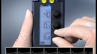 Sensing and Threshold Test — 53401 Temporary Pacemaker [upl. by Alton443]