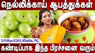 வேண்டவே வேண்டாம் இப்படி பயன்படுத்தாதீர்கள்  Nellikkai juice  Healthtips  DrNithya  Mr Ladies [upl. by Ezra376]