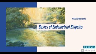 Basics of Endometrial Biopsies Tutorial for Residents [upl. by Ramhaj]