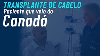 Transplante capilar em paciente que mora no Canadá [upl. by Bahe]