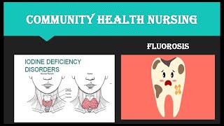 community health nursingnon communicable disease iodine deficiency disorder Fluorosis [upl. by Patnode681]