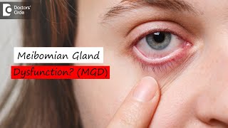 Meibomian Gland Dysfunction MGD amp How it is corrected  Dr Sunita Rana Agarwal  Doctors Circle [upl. by Hsekin]