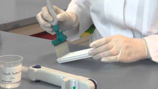 Immunoblot Test Systems Laboratory Assays for Diagnosing Autoimmune Diseases Autoimmunity [upl. by Elyc368]