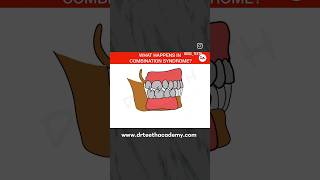 Combination Syndrome drteeth [upl. by Kalasky]