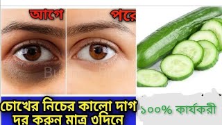 মাত্র ৩দিনে শসা দিয়ে চোখের নিচের কালো দাগ দূর করুন।ডার্ক সার্কেল দূর করার সহজ উপায়। [upl. by Ytisahcal]