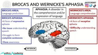 69 SECONDS on BROCAS and WERNICKES APHASIA Never get them mixed up again [upl. by Holt]