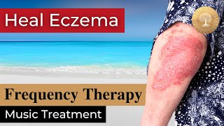 Eczema Music Therapy ๏ All Rife Frequencies Skin Problems Treatment ๏ Healing Nature Frequencies [upl. by Lindley]