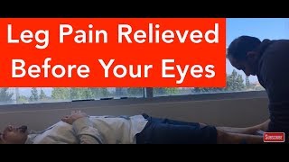 Leg Pain Relieved Before Your Eyes With ASTR [upl. by Annirok608]