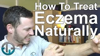 How To Treat Eczema Naturally [upl. by Keli]