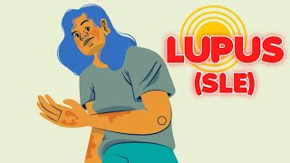 Systemic Lupus Erythematosus updated 2023  CRASH Medical Review Series [upl. by Fassold]