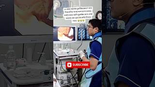 E R C P 🩺 Gallstone Operation is in Progress 🇧🇩 👈 Operation Theatre  90 Years old Man  shorts [upl. by Iives]