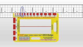 EKG Concepts  How To Use The EKG Badge [upl. by Aaberg]