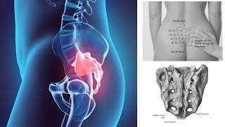 SACRUM LOCATION METHODS AND CUN MEASUREMENTS [upl. by Wiskind]