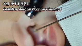 ASMR Real Series 스텐귀이개 귀청소 stainless steel ear picker ear cleaning  ステン耳かき 耳掃除 [upl. by Niwle766]