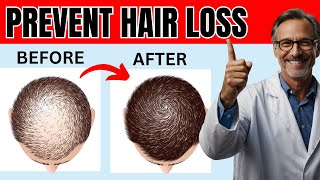 12 Proven Remedies to Prevent Hair Loss and Regrowth Regrow hair [upl. by Yecrad375]