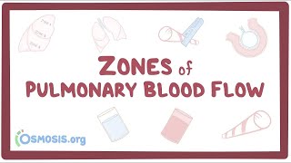 Zones of pulmonary blood flow [upl. by Aehtela575]