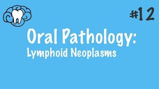 Oral Pathology  Lymphoid Neoplasms  INBDE ADAT [upl. by Akiret]