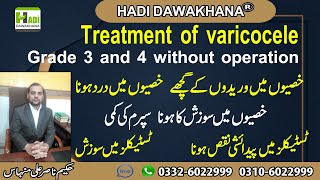 Varicocele symptoms and treatment  Varicocele treatment in urdu  Varicocele kya hai  Varicocele [upl. by Mccollum402]