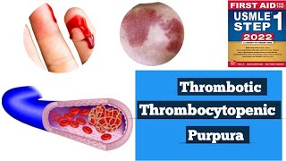 Thrombotic thrombocytopenic purpura TTPHUS Hematology lacturesDoctors goal [upl. by Oguh885]