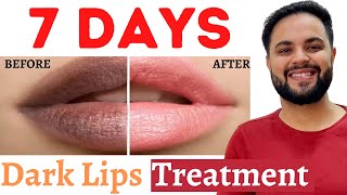 7 Days Dark Lips Removal Challenge  Pigmented Lips Treatment [upl. by Ettevahs]