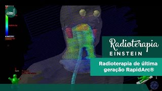 Radioterapia de última geração RapidArc® [upl. by Ludvig]