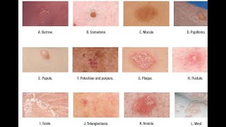 Skin Lesions with defination [upl. by Merill]