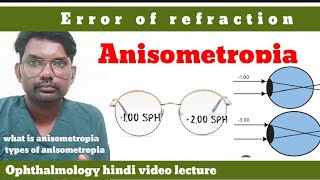 anisometropia  error of refraction  what is anisometropia  anisometropia  optometryhindi [upl. by Yonatan964]