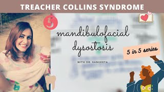 treacher collins syndrome [upl. by Cayser]