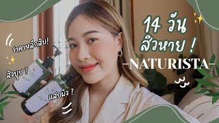 รีวิวรักษาสิวหลักสิบ  เห็นผล 14 วัน ลองมาแล้วววว สิวหาย TEA TREE NATURISTA 💚  faiichada [upl. by Gerfen]