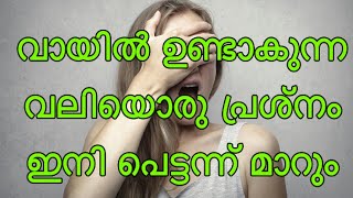 ഇനി വേദന സഹിക്കണ്ട വായിൽ ഉണ്ടാകുന്ന വായ്പുണ്ണ് മാറാൻ ഇനി ഇത് മതി Mouth ulcers remedies [upl. by Haughay]