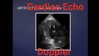 Echocardiogram  Basic physics and instrumentation  Fundamentals [upl. by Barling]