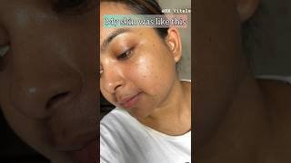 My honest review of HK vitals skin radiance collagen ✅ ad HKVitalsCollagen shorts skincare [upl. by Mikaela]