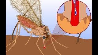 Leishmaniasis life cycle [upl. by Saxela]