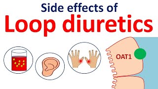 Loop diuretics side effects in easy way  Furosemide bumetanide torsemide [upl. by Ekard]