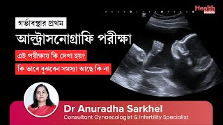 গর্ভাবস্থার প্রথম আল্ট্রাসনোগ্রাফি  Easy process to understand Ultrasound report of 1st trimester [upl. by Mears]