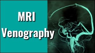 MRI Venography  Phase  Contrast  3D [upl. by Ardnasil703]