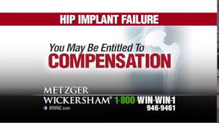 Defective Hip Replacement Lawyers  Pennsylvania Attorneys [upl. by Magdaia]