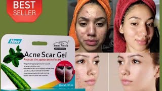 Acne Scar GelAcne and acne scar removal creamRemoves small black spots and smooths the face cream [upl. by Ajroj563]