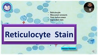 Reticulocyte stain supravital stains used for reticulocytes  Hematology  by Imran Yaseen [upl. by Adalie]