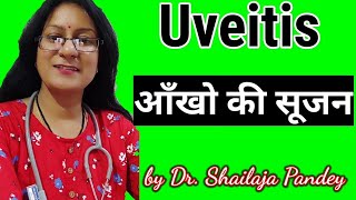 Uveitis treatment of uveitis यूवाइटिस आंखों की सूजन uveitis [upl. by Aneet]