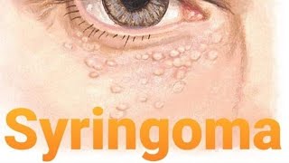 how to remove syringoma or skin tag 🤔  Tagalog syringoma skintags [upl. by Eynttirb]