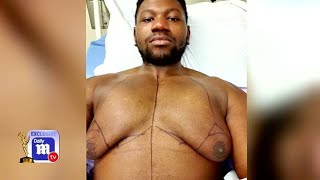 Man reveals the trauma of living with gynecomastia [upl. by Zeitler800]