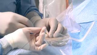 Transradial Cardiac Catheterization [upl. by Aidnic860]