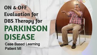 ON OFF Evaluation for DBS levodopa Challenge test for Parkinson Disease Clinical based learning [upl. by Janelle441]