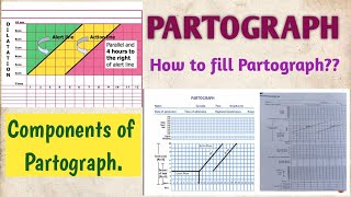 PARTOGRAPH COMPONENTS OF PARTOGRAPH HOW TO FILL OR PLOT PARTOGRAPH [upl. by Esile982]